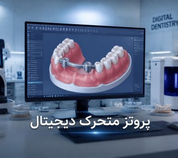 پروتز متحرک